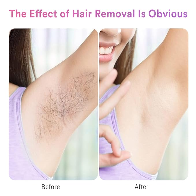  A before and after comparison image showing the effects of hair removal. On the left side, labeled "Before," there is an armpit with noticeable hair growth. On the right side, labeled "After," the same armpit is shown to be smooth and hair-free. The text at the top of the image reads "The Effect of Hair Removal Is Obvious." The person in the image is wearing a sleeveless lavender top.