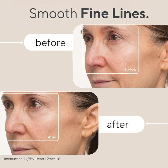 A side-by-side comparison of a woman's face showing the "before" and "after" effects of using a skincare product for 12 weeks. The "before" image highlights visible fine lines around the eyes and cheeks, while the "after" image shows a smoother complexion with reduced fine lines. The text emphasizes the product's ability to "Smooth Fine Lines," with a disclaimer stating that the images are unretouched and based on once-daily use over 12 weeks.